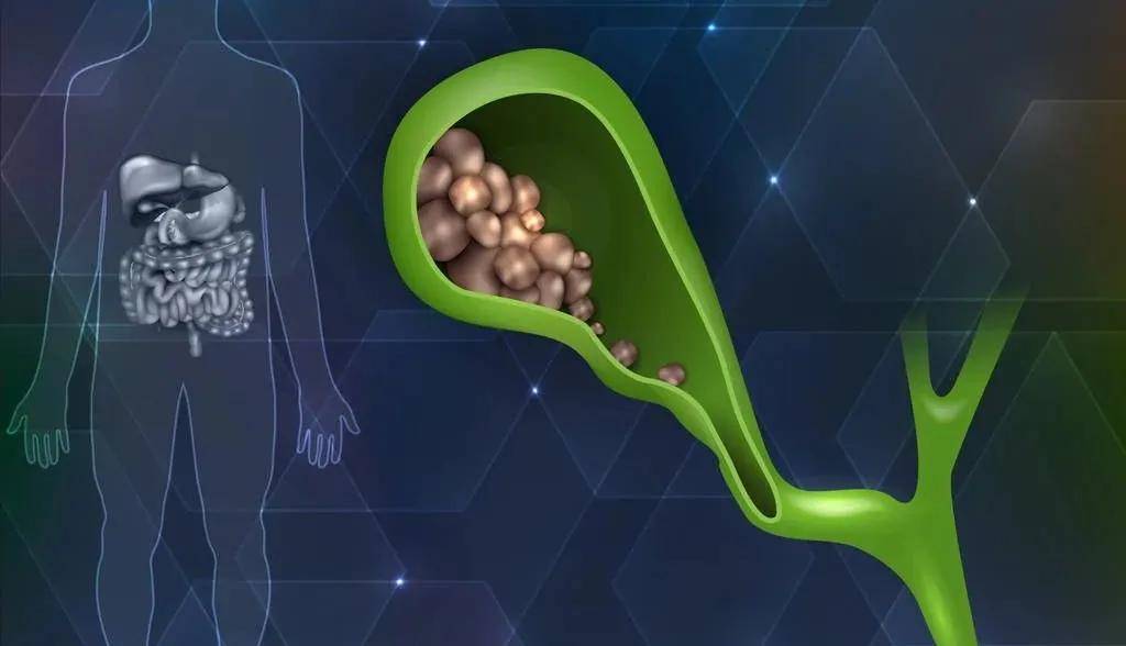 症状|这种病“重女轻男”，还专门欺负不爱吃早餐的人……