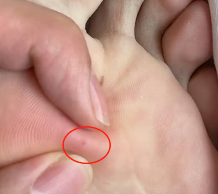 但他的脚被钉子刺伤后,整个人控制不住地倒在地上,当时的情况并不是很