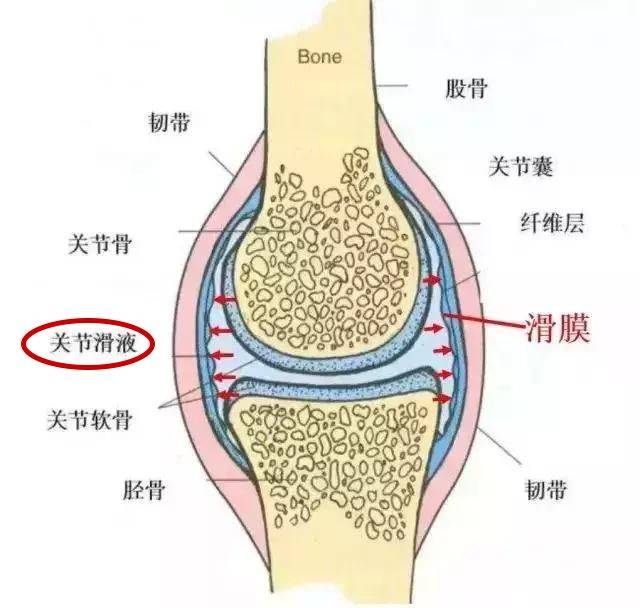 膝關節檢查出來有積液一定需要抽液麼