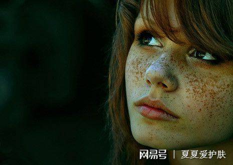 雀斑|色素斑点如何高效解决？圣秋波给你答案