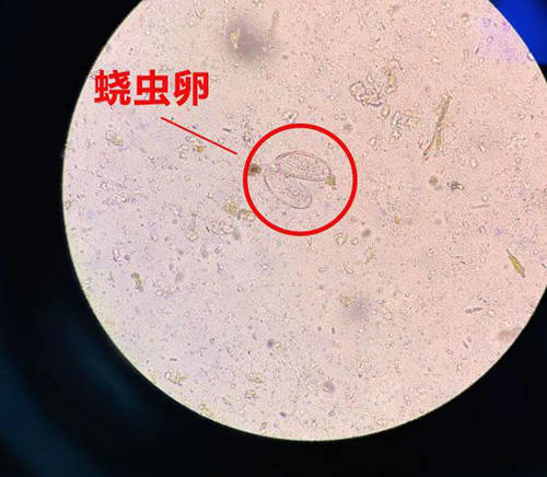 线虫微生物的样子图片