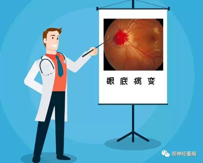 不要忽视糖尿病情况出现的眼底病变 视网膜