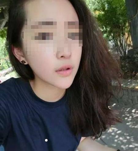 下巴|美女下巴经常传出恶臭，医院检查后，当场呕吐