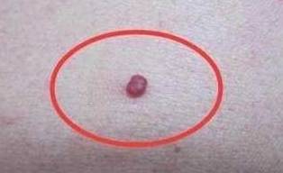 什么|乙肝病人身体不适被认为是心理暗示，大多是医生的安慰说法！