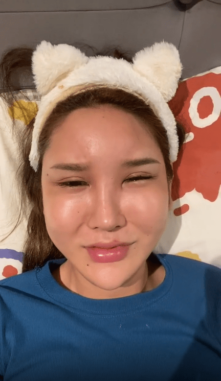 因为|女网红出现整容后遗症，脸肿成馒头眼睛睁不开，崩溃痛哭称自己要去住院了