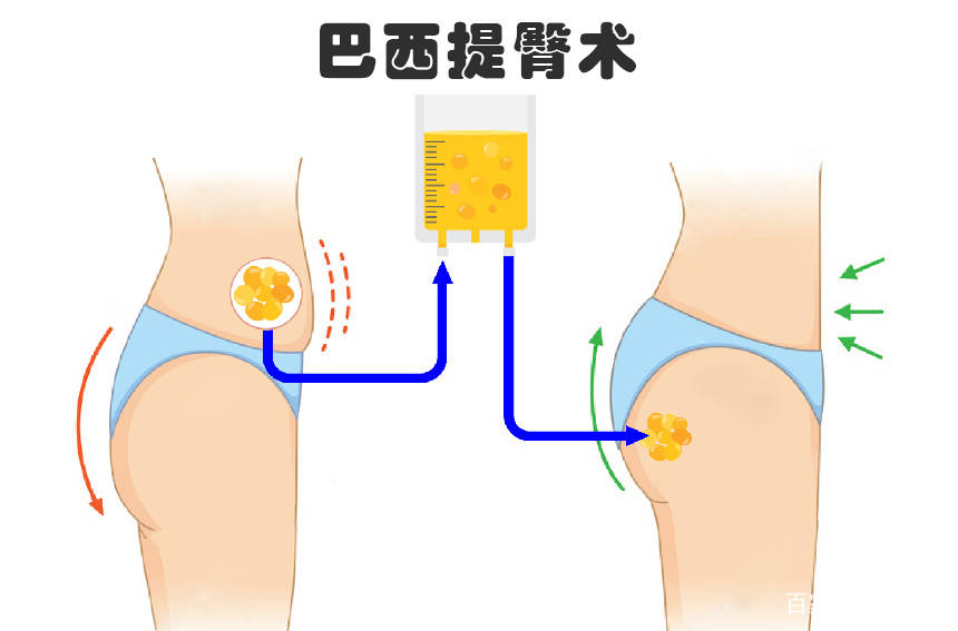 永久|某种意义上来说，会带来负面影响的9种美容行为