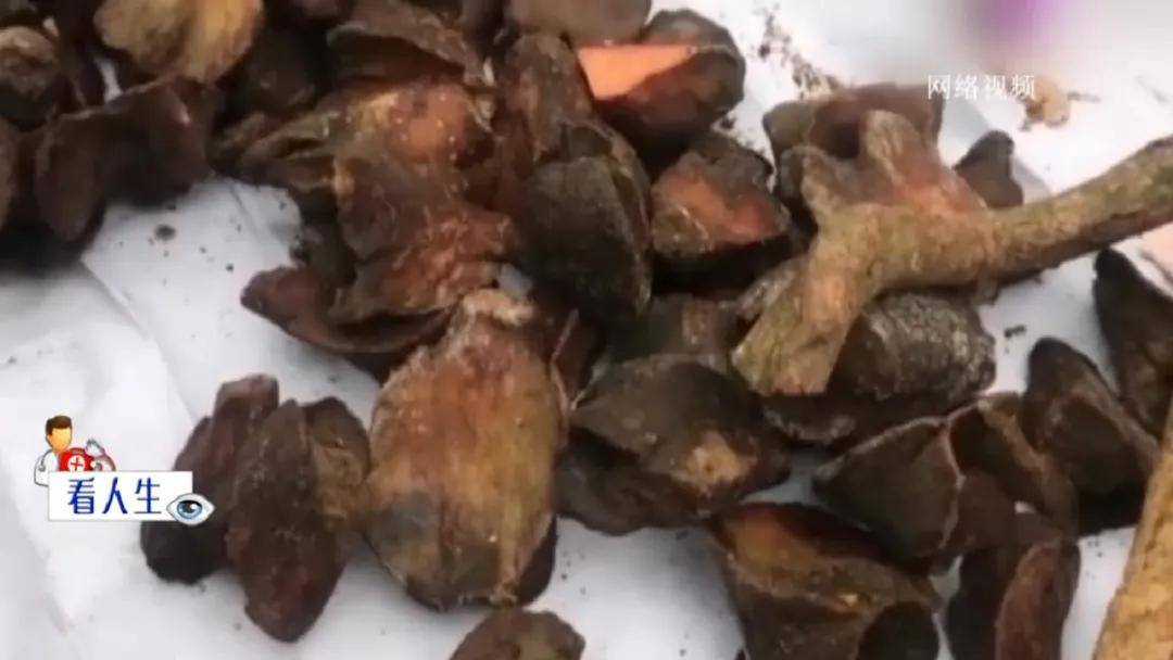 急诊室|自行购草药治腰病竟然出现这些症状！药，真的不能乱吃！