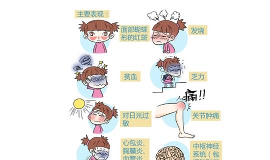 症状|狼疮性肾炎是什么？有什么症状？看了您就懂了！