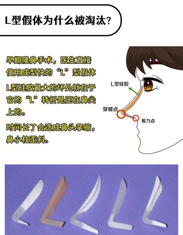 挺翘|为什么韩佳人小翘鼻被整形模板淘汰了？她凭什么成为新美鼻模板？