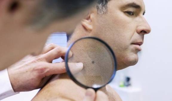 症状|这5种皮肤症状，或警示着肝脏受损严重，并不难察觉