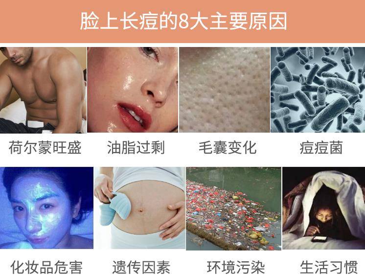 因为|脸上长痘痘是因为什么原因引起的？怎么才能把脸洗干净？（图片）