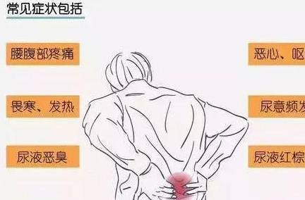 转氨酶|夏季肾结石高发，8个报警信号你收到了吗？