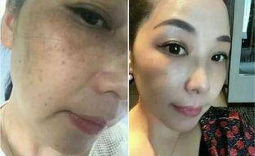 皮肤修复需要多少天 e25454e7eaf7437da8af19bed365643b.jpeg