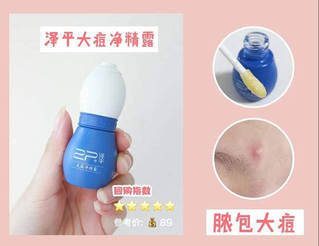 祛痘|粉刺没了、痘痘走了,冬日这几招,能让你脸变得白净又光滑