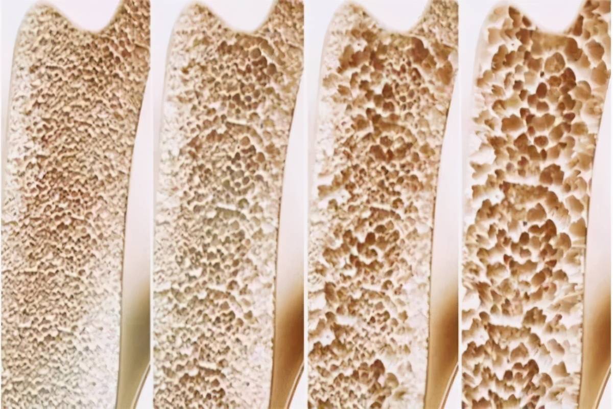 补充|昆明中研医院：甲减和很多疾病都是有关系的，下面让我们一起来了解下吧