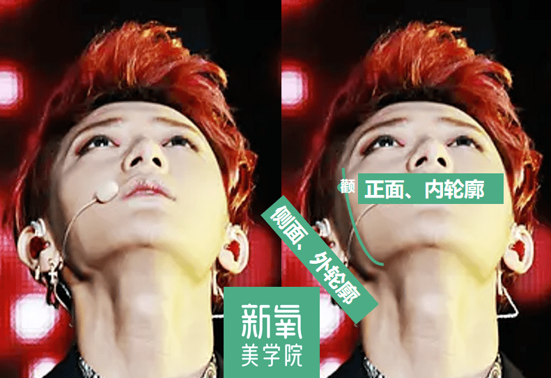 眉骨|给赵露思换了天使大宝贝的眉骨和眼眶骨,这张脸洋气指数飙升120%