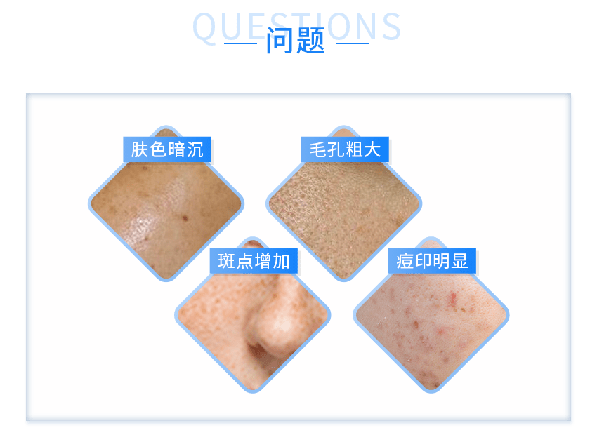 功能|《水初语莹莹护肤课堂》痘痘看1，敏感看2，斑点看3