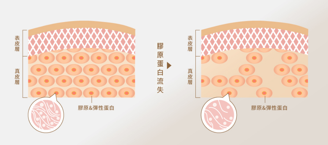 形态|怎么样看起来年轻？——王小民教授帮您解答