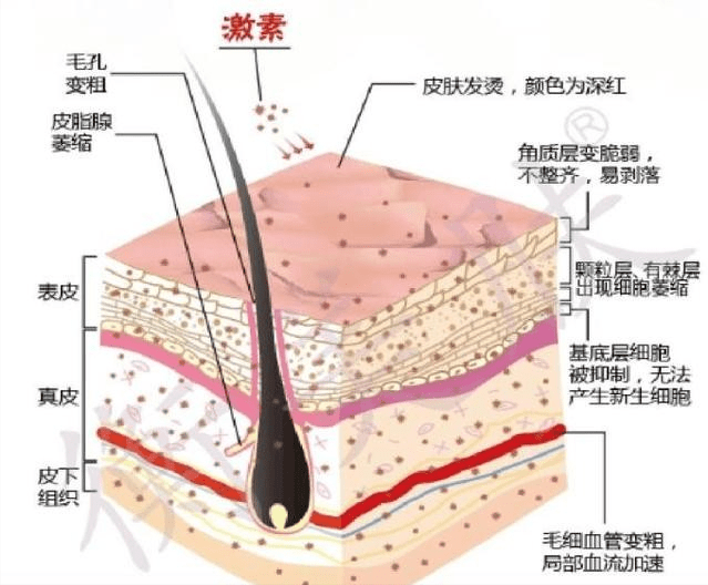 表皮层|苗小仙面膜告诉你为什么人需要护肤呢？护肤意义在哪呢？