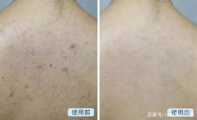 因为|26岁昆凌美背撩人，上万衣裙藏不住凹凸感，俩娃妈不简单