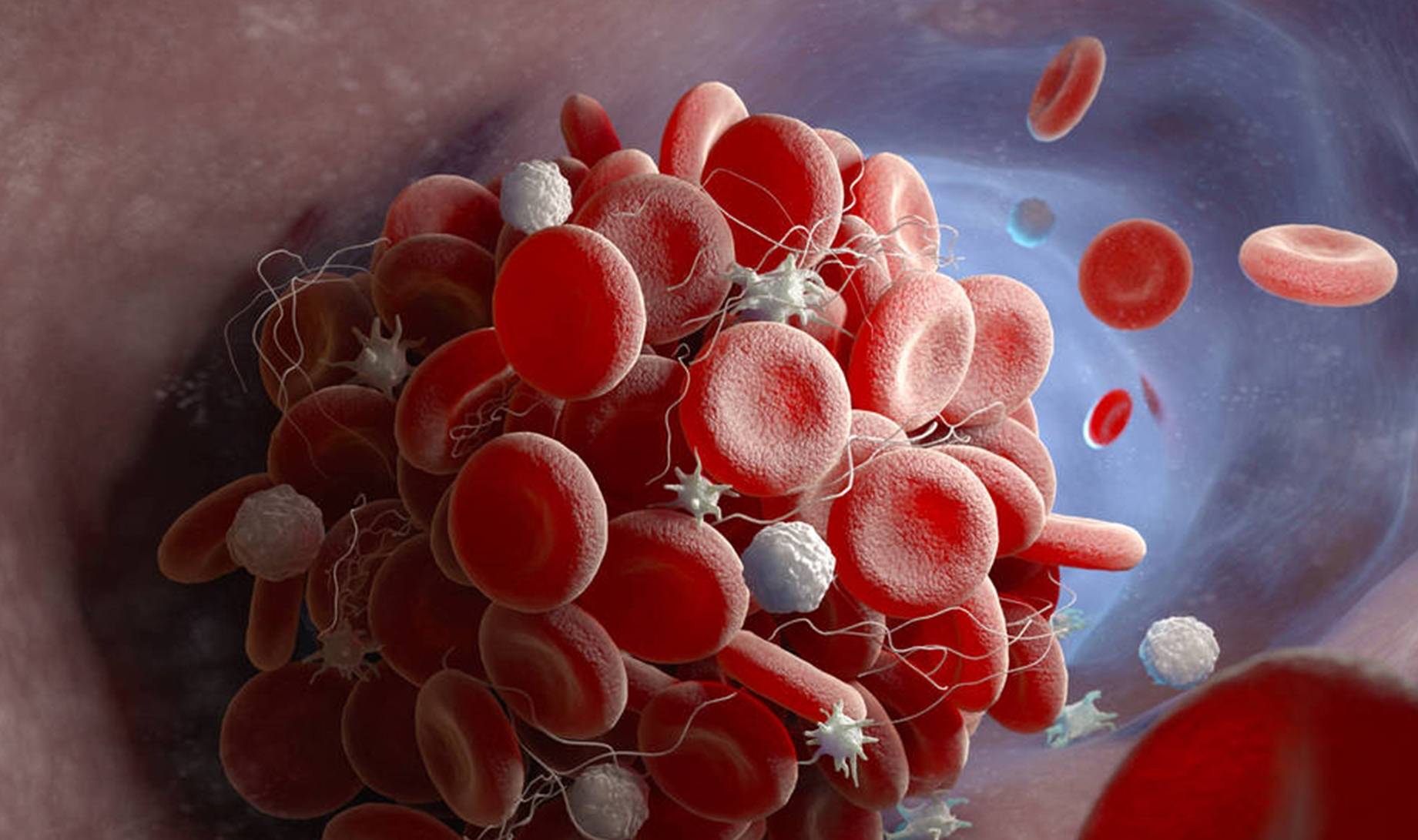 什么是电解质紊乱是如何形成的 30d30c6cc3ba425c9d4820ef353cf4fc.jpeg