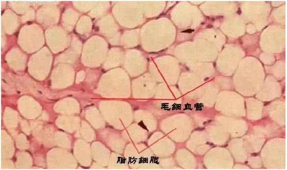 面部|自体脂肪填充面部多久恢复自然？说7天就恢复的确定没吹牛？