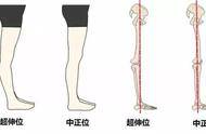 私信|生活中有哪些不良習慣會引起膝蓋疼痛呢？