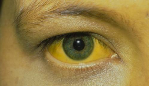 因为|肝脏的“解毒王”找到了，不是大蒜，白开水中加一物，给肝洗洗澡