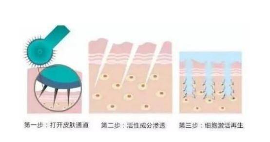 人群|问题肌研究所打造养肤新时代，伊肤泉祛痘邀你焕亮肌肤