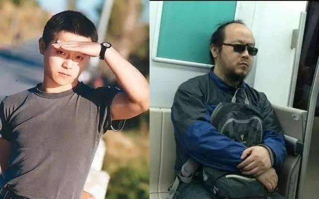 假发|不只是黄晓明，半个娱乐圈都“秃”了，连00后都跟假发片较上劲了