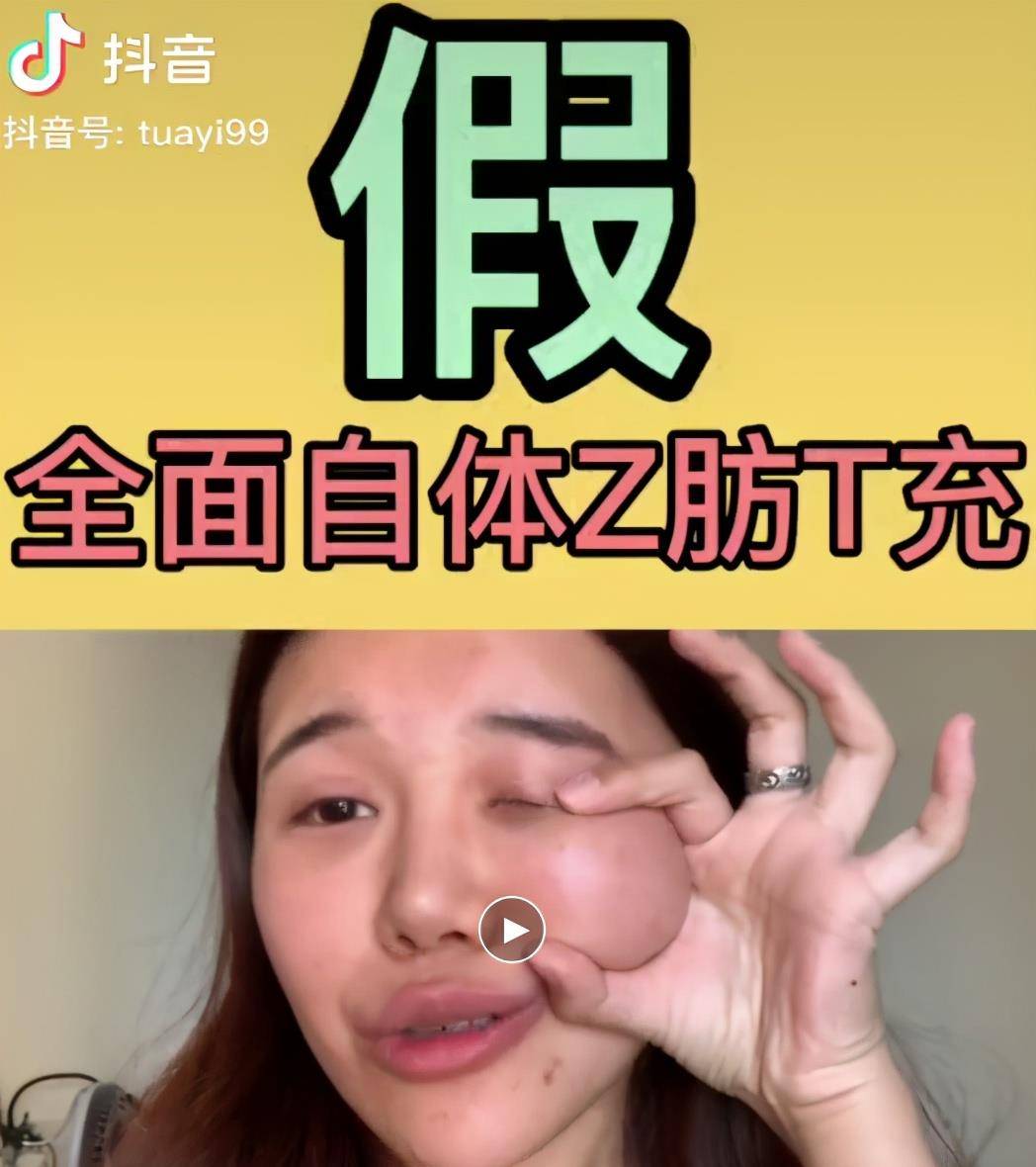 心理准备|王子文全脸填充变甜美，但你是否提前做好了整容风险的心理准备？