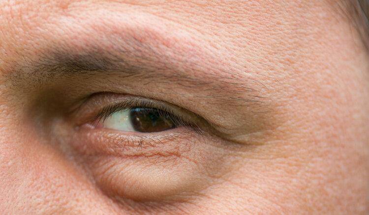 肾脏|肾功能受损有哪些征兆?提醒:除了泡沫尿,这6种症状也别大意