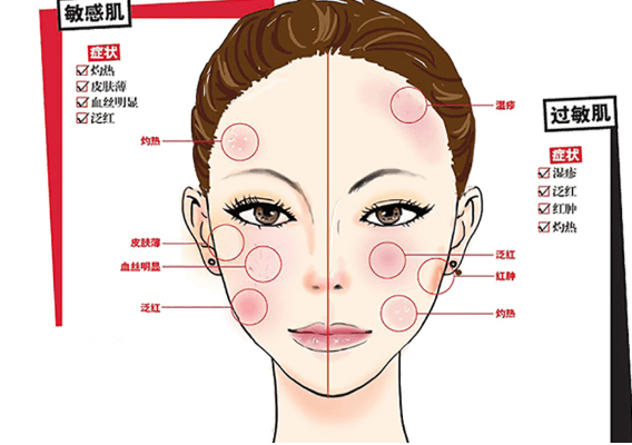 人群|敏感肌人群“迷惑”行为图鉴大赏（二）