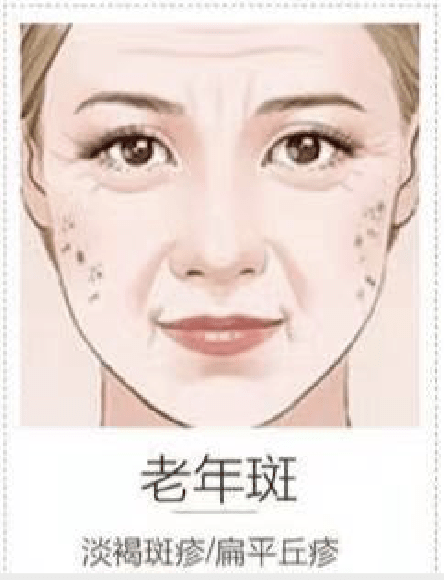 3012a167f79b4a9cb2986fa1d1301ace.png