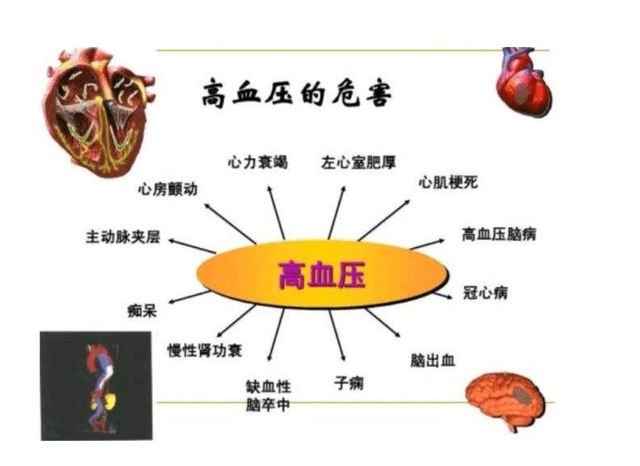 高血压患者心脑血管疾病不可不防饮食做好这四点更加健康