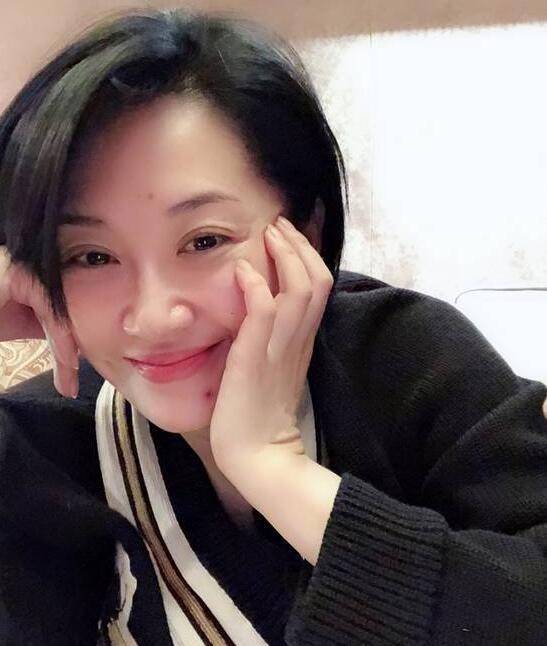 少女|许晴都快成老奶奶了，为装少女瘦脸成尖下巴，不像她还没了气质！