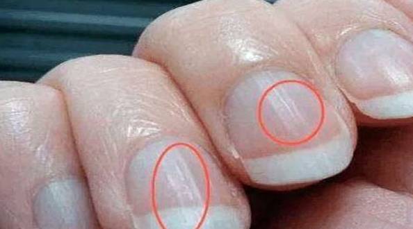 症状|身上3处变黑2处变臭，夜里2个时间总惊醒，可能是肝脏在“求助”