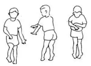 综合征|盘点小脑萎缩共济失调的主要症状都有什么呢