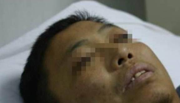 肝脏|中医提醒：肝脏受损，身体3个表现“藏不住”，很多人不在意