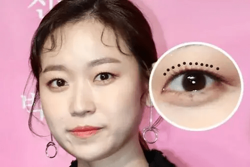 眼睛|什么样的长相特点会显“土味”？女明星都是怎样悄悄变精致的？