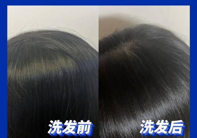头皮|超难用的洗发水避雷，你中招了吗？