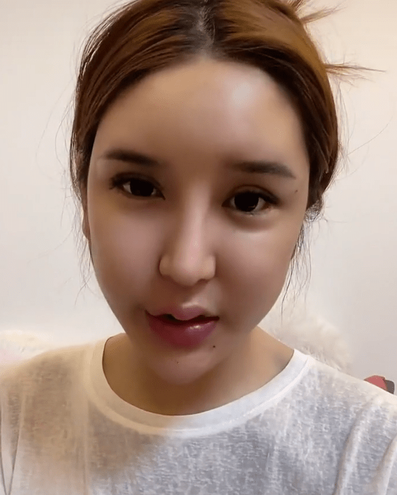 因为|女网红注射奥美定8年后爆发问题，额头内部溃烂，透露胸和屁股都曾注射奥美定