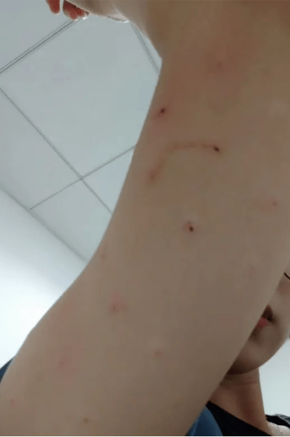 灰尘|被过敏折磨到鼻涕眼泪横流，别人总以为我哭了，还递纸巾给我