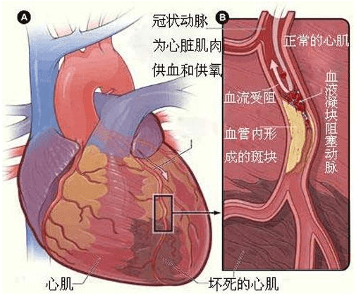 模型|炎症的危害你了解吗 芝麻素的抗炎机制