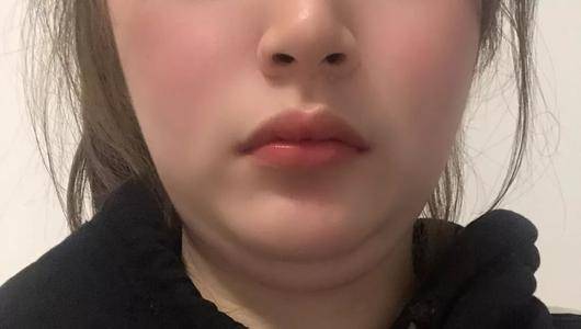 面相解析:双下巴和尖下巴两种运势相反的面相