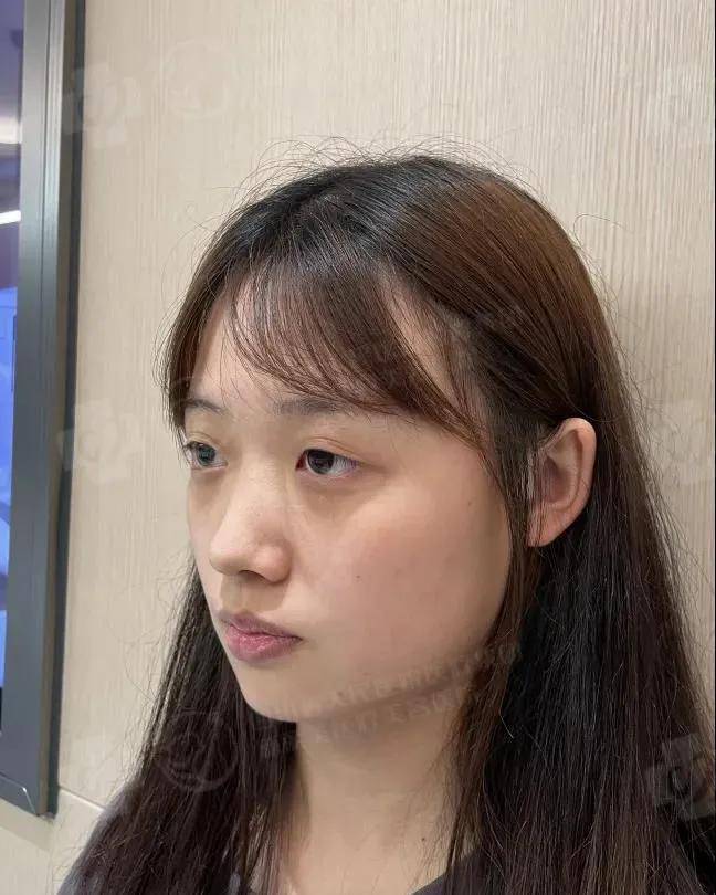进行|“这些双眼皮贴我用不到了，你一半我姐一半”