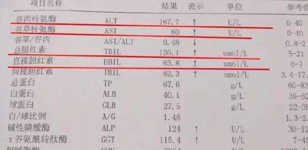 补充|慢性乙肝选择水果，如何既能解暑清热，又能够促进肝脏代谢？