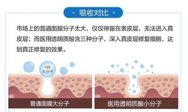 功效|秋季干性肌肤一用就会爱上的保湿面膜——古草凝萃透明质酸钠保湿贴