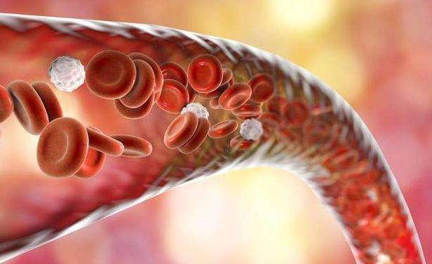 软化血管预防血管堵塞 dced193e3b644b73a6816492c5bbd11d.jpeg