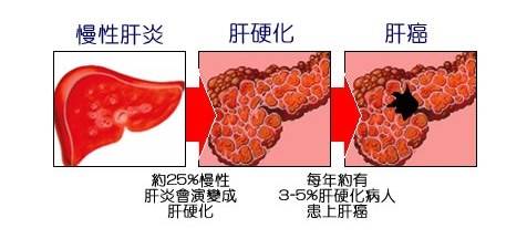 生活|身体长出“小红点”，是“肝癌”典型症状之一，不要忽视！